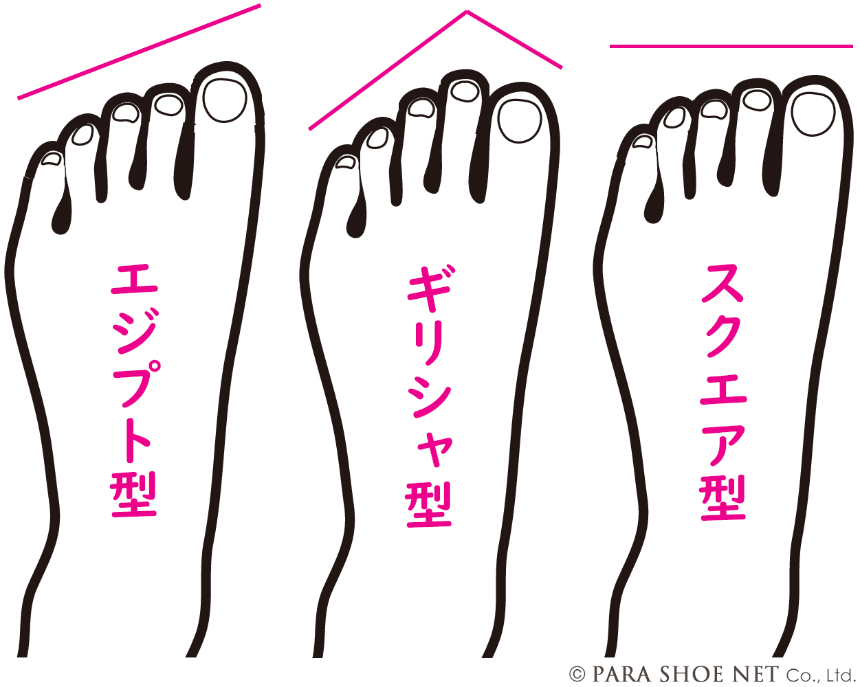足指（つま先）の形の3つのタイプ－エジプト型、ギリシャ型、スクエア型