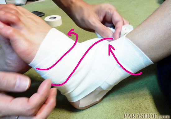 足首の捻挫　包帯によるテーピングで足首を固定する
