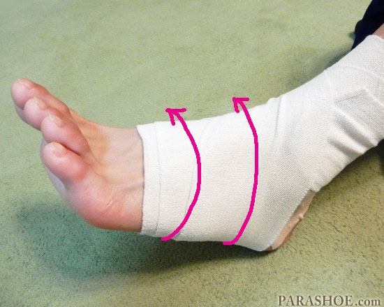 足首捻挫を包帯によって固定