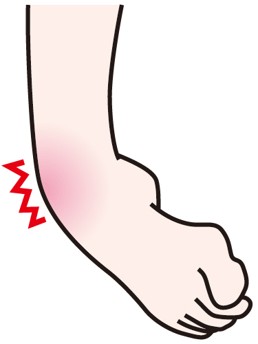 捻挫 足首捻挫 の原因と対処方法 応急処置 包帯による固定 巻き方 セルフケア テーピング方法など 靴専門通販サイト 靴のパラダイス