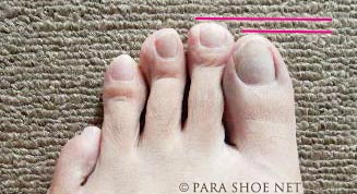 足指の人差し指（第二趾）が、親指（母趾・第一趾）より長い足の写真